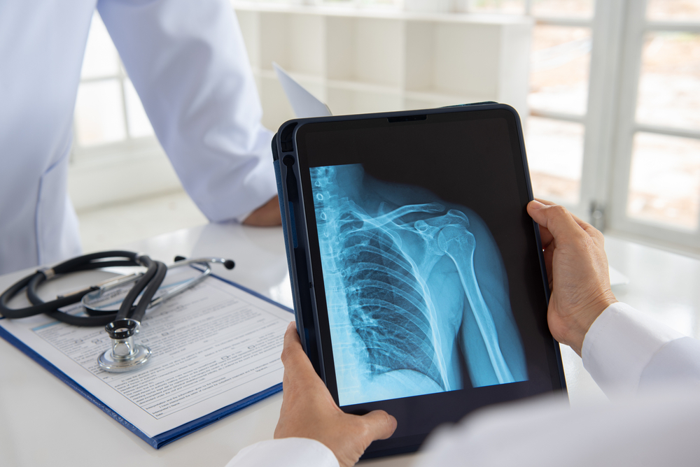 After Diagnosis Through X-Ray service, Doctor Checks the Report | Med-Pro